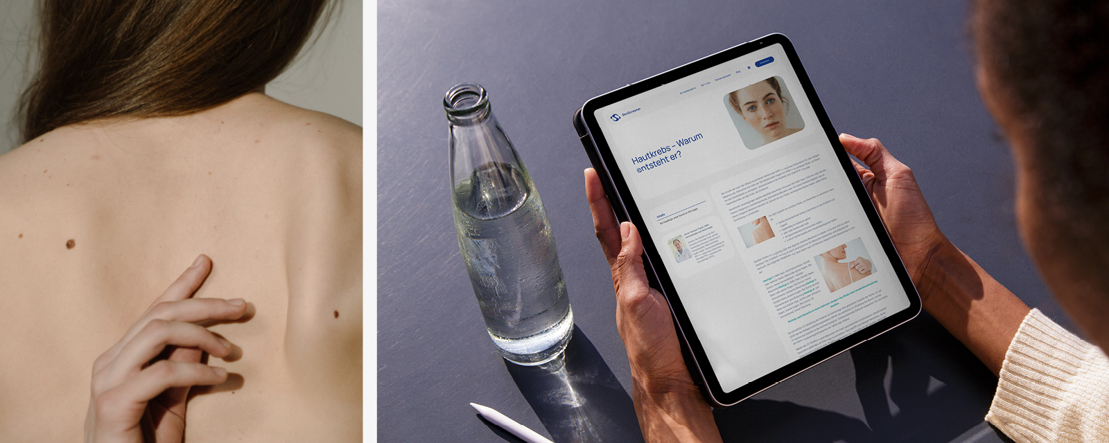 Eine Frau analysiert mit einem SkinScreener-Tablet ein Bild des Rückens einer Frau.