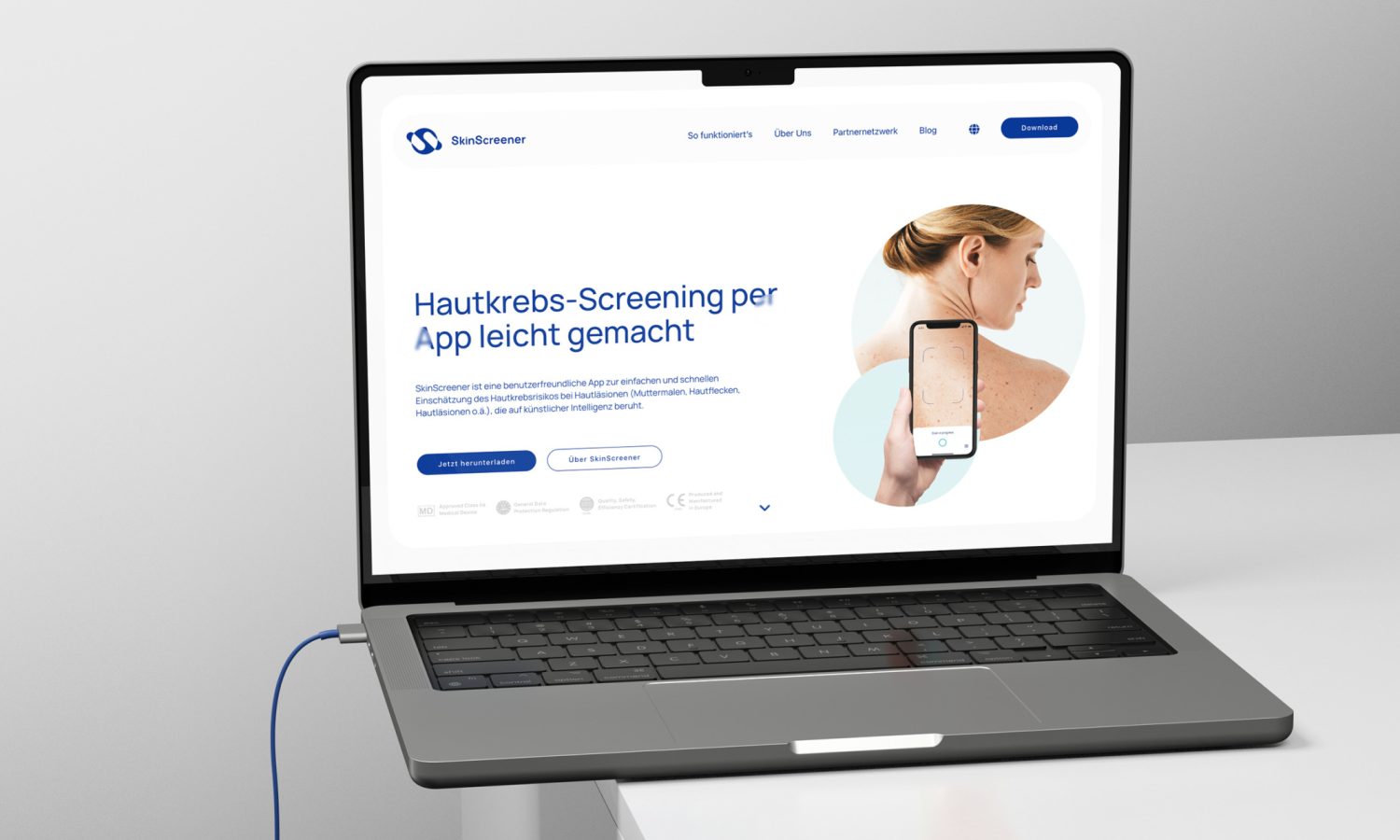 Auf einem Tisch steht ein SkinScreener-Laptop mit einer Frau darauf.